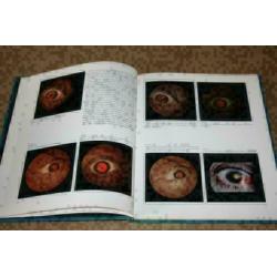 The Fundamentals of Ophthalmoscopy (Oogspiegel) !!
