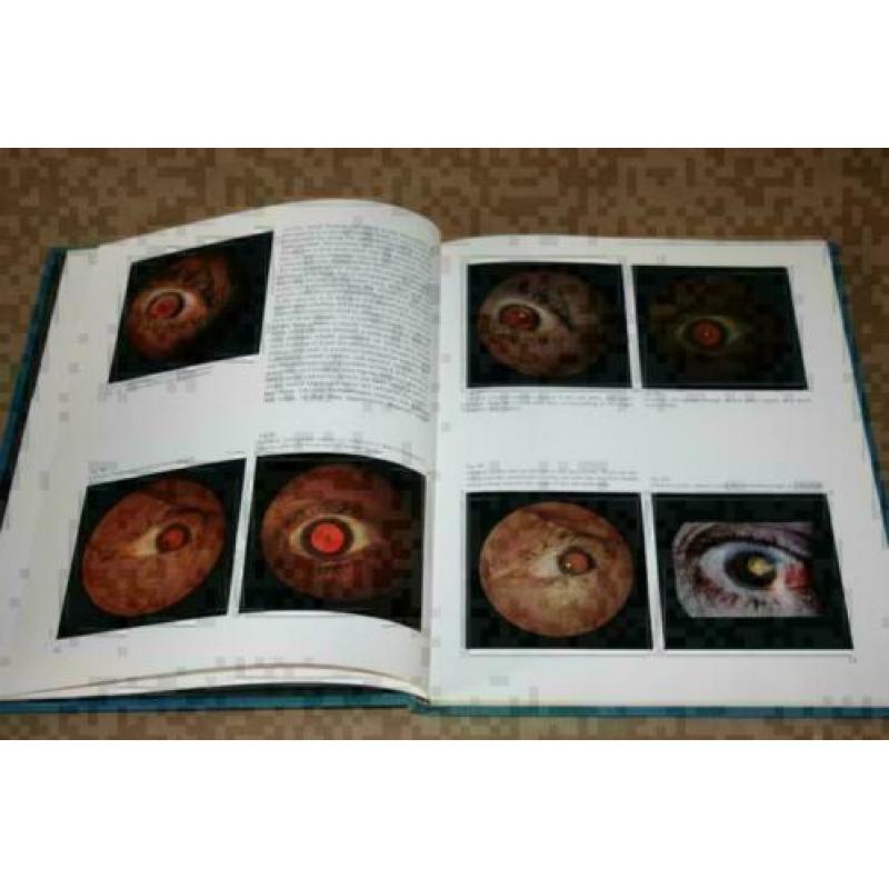The Fundamentals of Ophthalmoscopy (Oogspiegel) !!